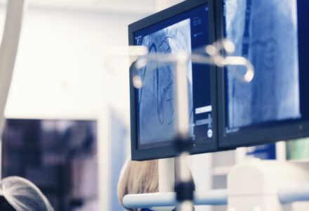 Cardiologicum Herzkatheter