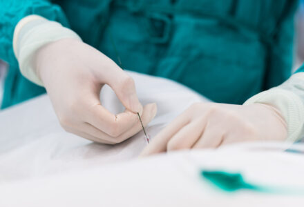 Cardiologicum Mitraclip